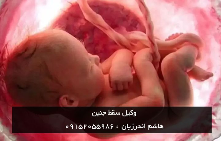 وکیل جرم سقط جنین در مشهد